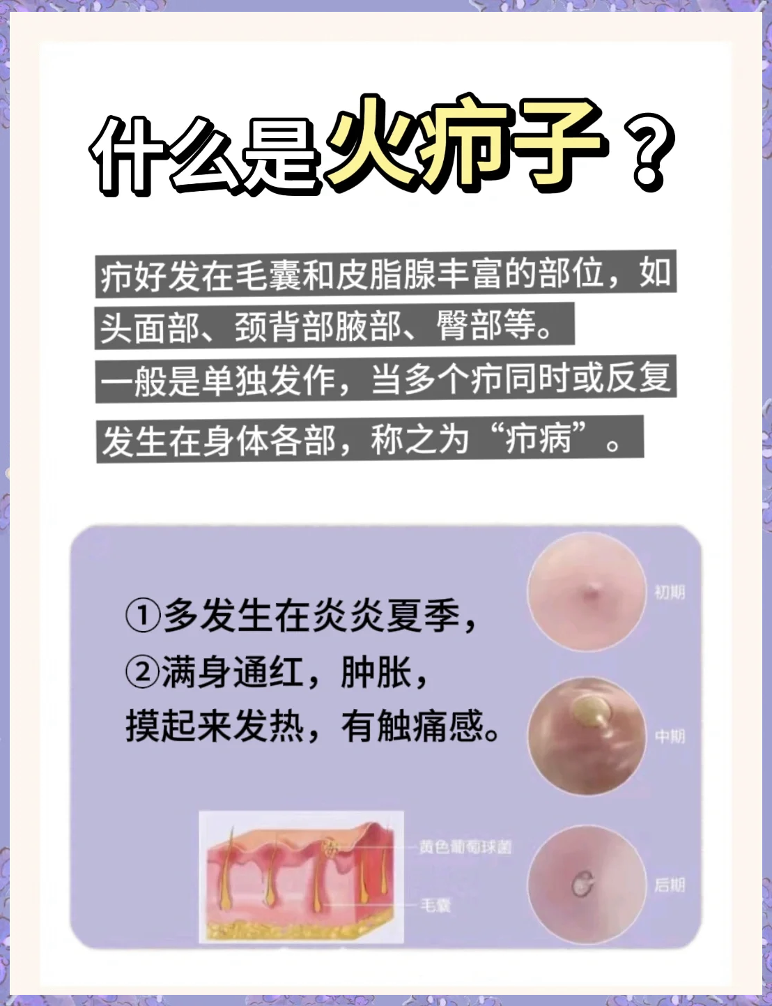 疖子怎么读